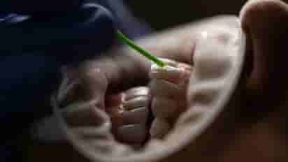 Restorative dental treatment